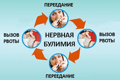 Лечение булимии в Кантемировке